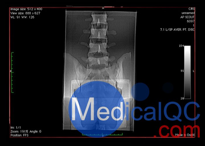 CIRS 034腰椎模體，CIRS 034穿刺訓練模體