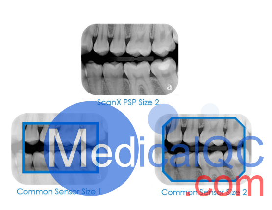 ScanX Duo數(shù)字X射線系統(tǒng),ScanX Duo口腔掃描儀