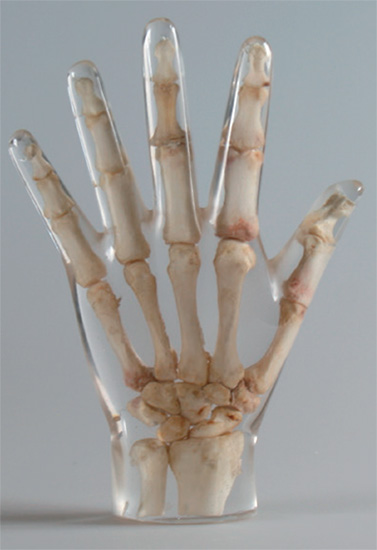 Erler Zimmer天然骨骼模體，Erler Zimmer手掌模體