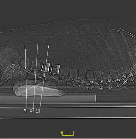 德國Erler Zimmer 7200天然骨骼全身模體，EZ 7200全身模體
