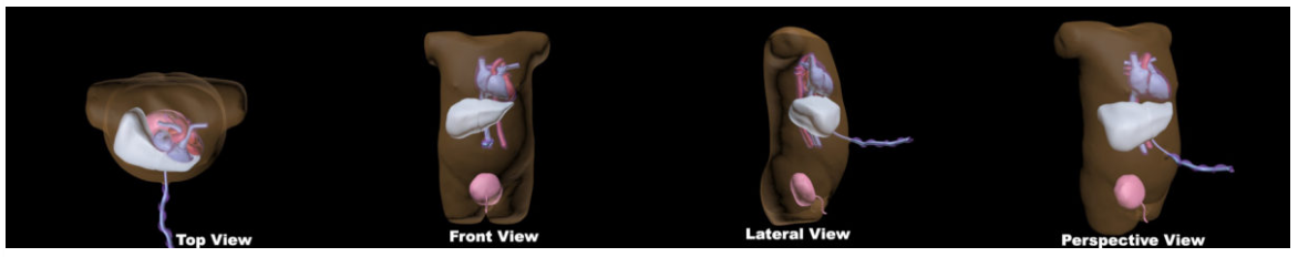 Truephantom US-NO1新生兒軀干超聲訓練模體,US-NO1新生兒軀干超聲模體