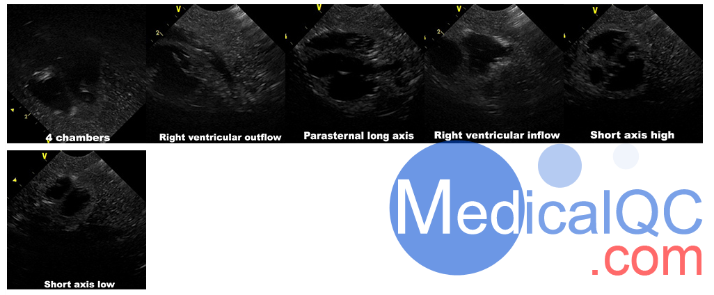 Truephantom US-NO1新生兒軀干超聲訓練模體,US-NO1新生兒軀干超聲模體