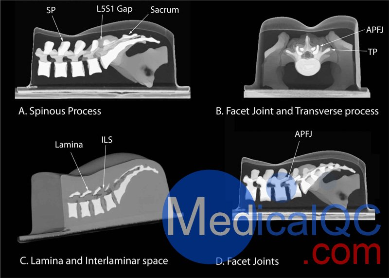 CIRS 034模體進行高分辨率計算機斷層掃描數據集的三維重建