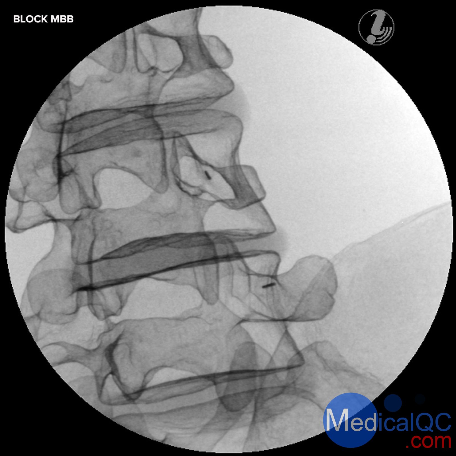 3B P65腰椎穿刺模體,P65腰椎穿刺訓練模體,3B P65模體,P65腰椎模體,P65腰椎穿刺訓練模體,P65穿刺訓練模體,穿刺訓練模體