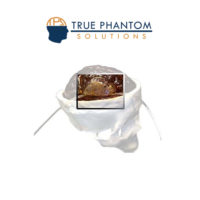 大腦動(dòng)脈瘤的血腫模體定制