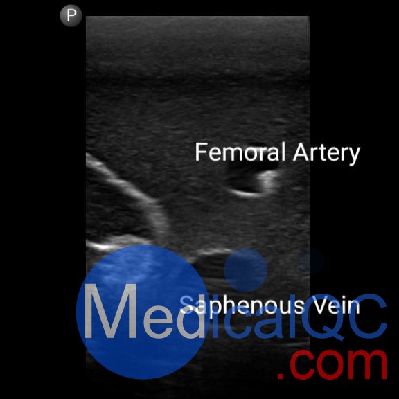 BPF1500-HP血管通路和區域麻醉超聲訓練模體，BPF1500-HP區域麻醉超聲模體