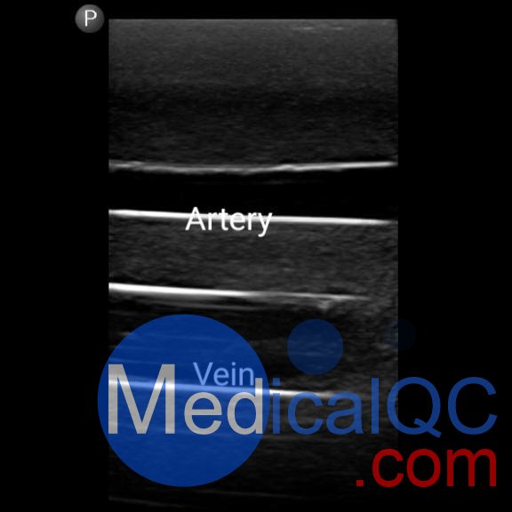 BPF1500-HP血管通路和區域麻醉超聲訓練模體，BPF1500-HP區域麻醉超聲模體