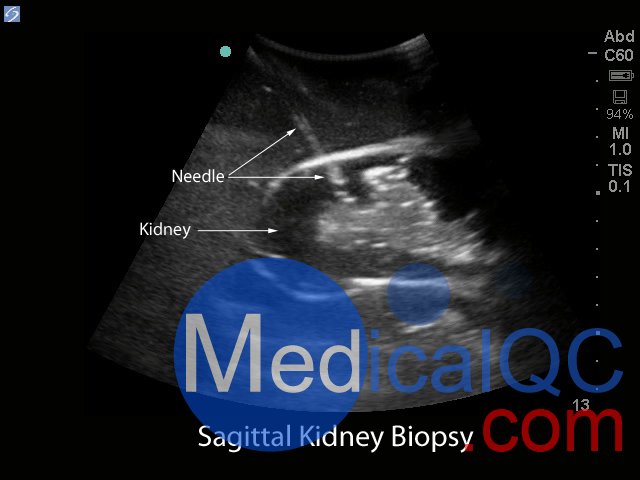 BPRB-2011腎活檢超聲訓練模型,BPRB-2011腎活檢模體