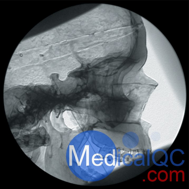 AR351脊椎穿刺模體，Adam，Rouilly脊椎穿刺模體