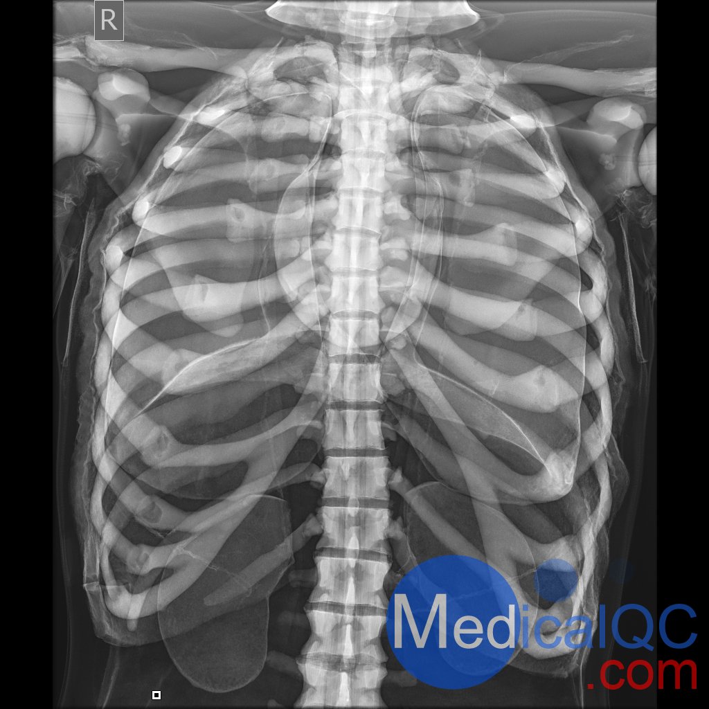 AR10A全身X射線照相定位模體，AR10A全身模體，AR10A X射線成像模體