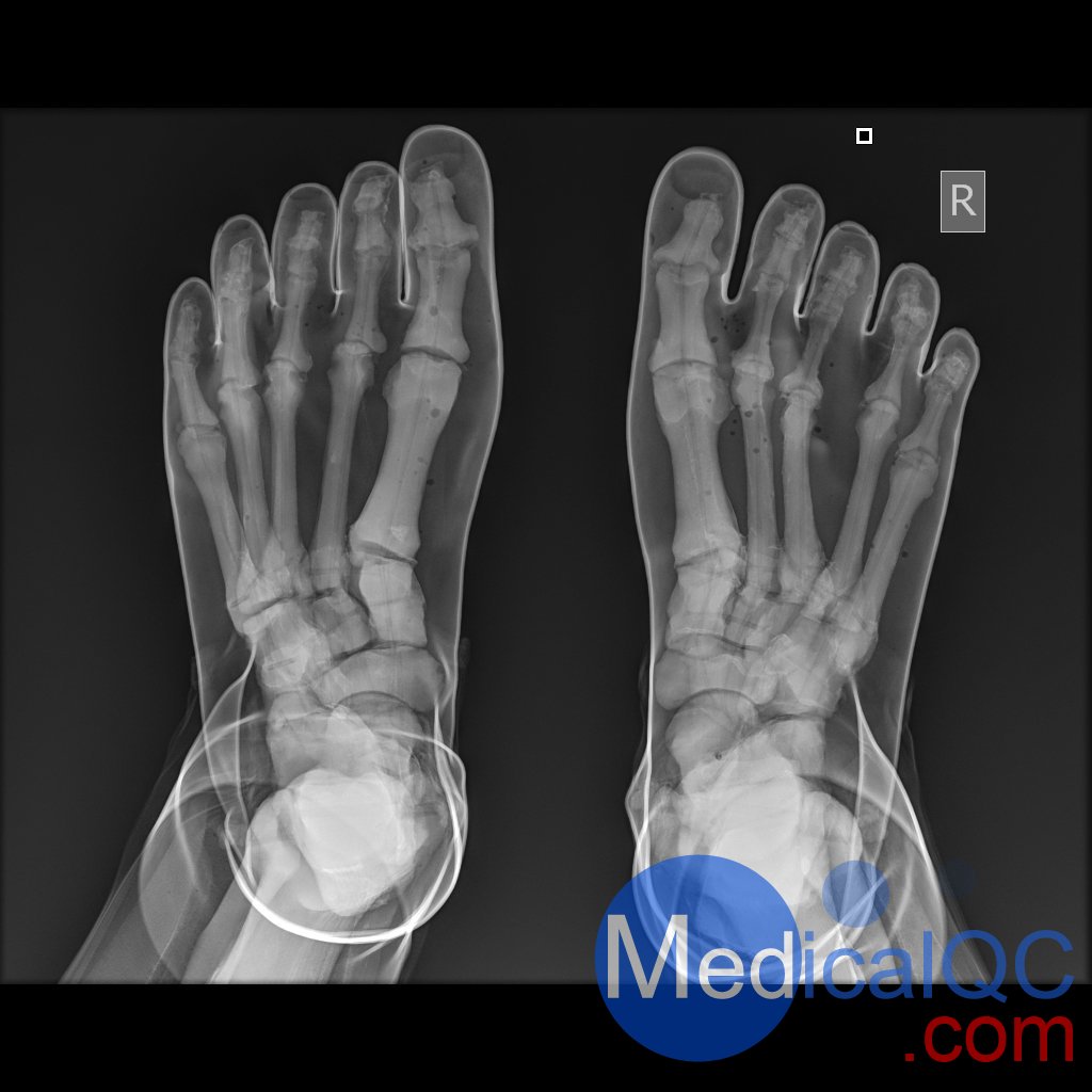 AR10A全身X射線照相定位模體，AR10A全身模體，AR10A X射線成像模體