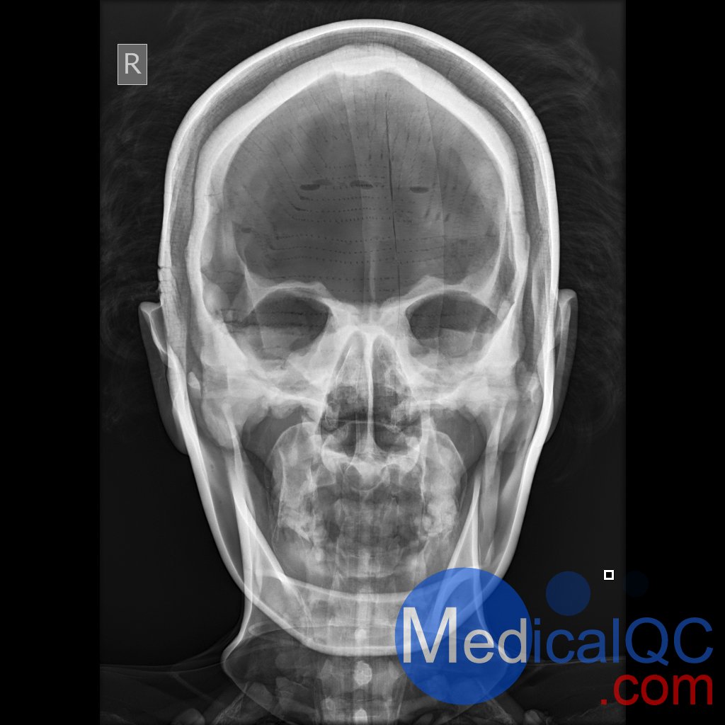 AR10A全身X射線照相定位模體，AR10A全身模體，AR10A X射線成像模體