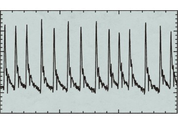 Multi+ 可變波形軟件,心律失常