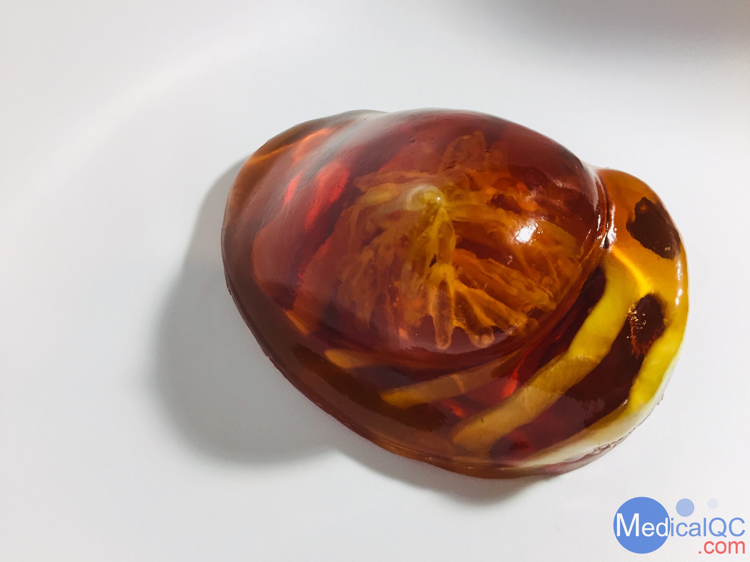 BT-A01乳房模體，BT-A01解剖乳房模體，Breast Phantom