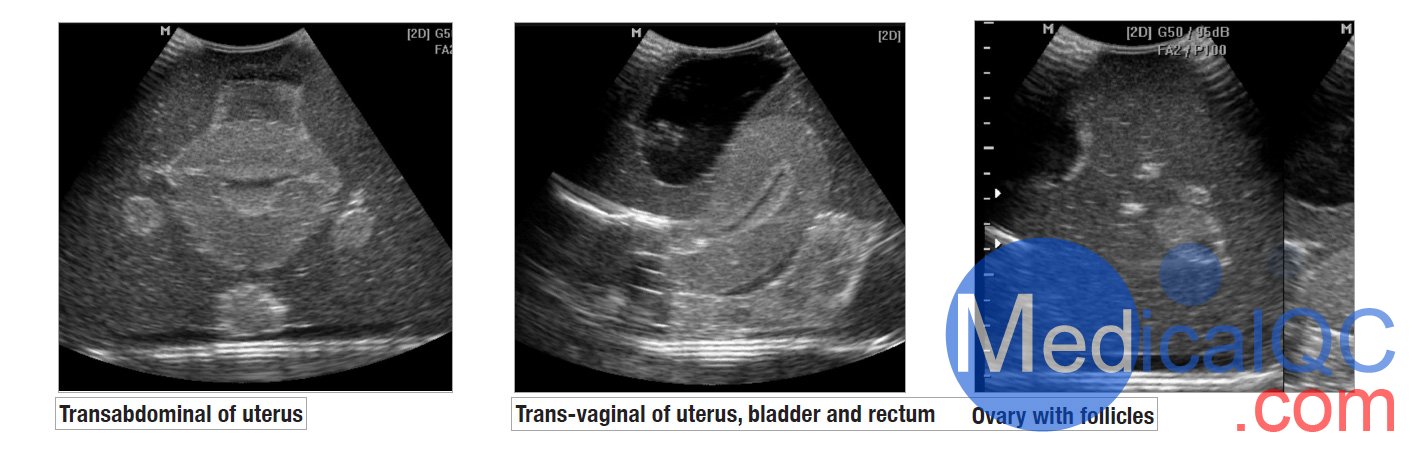 CIrs 404A女性盆腔模體,CIrs 404A超聲訓(xùn)練骨盆模體影像圖