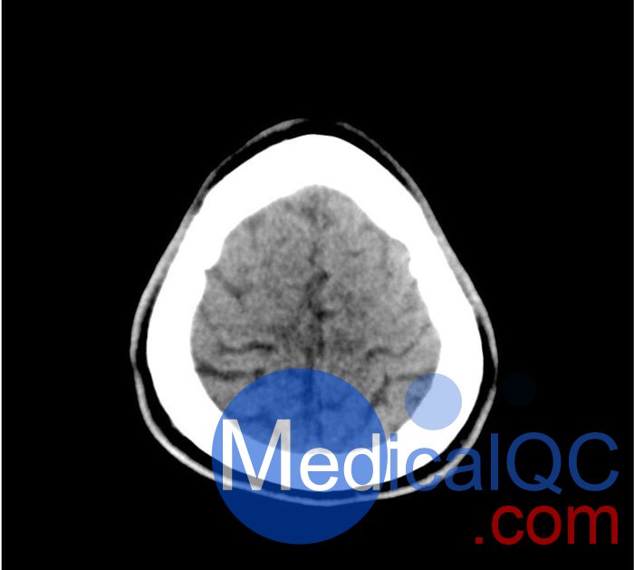 50-01頭部CT模體，50-01腦中風(fēng)頭部模體，50-01腦出血頭部模體