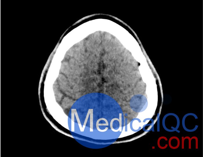 50-01頭部CT模體，50-01腦中風(fēng)頭部模體，50-01腦出血頭部模體