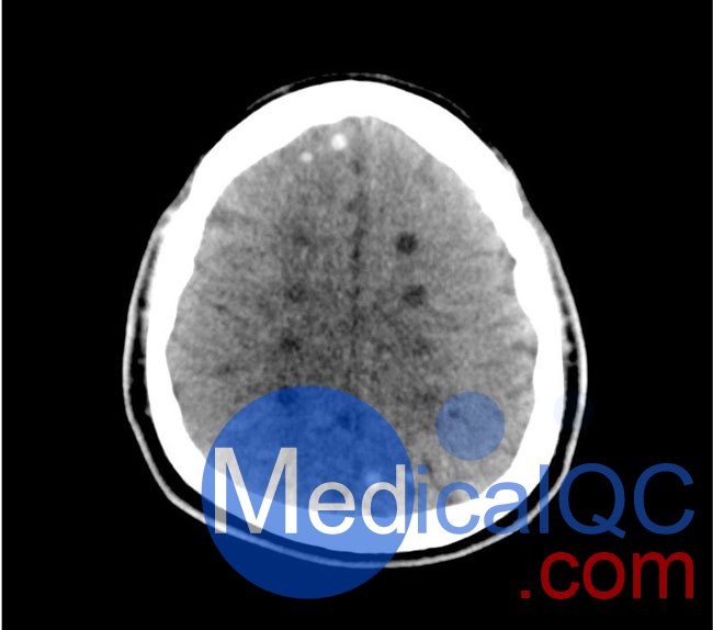 50-01頭部CT模體，50-01腦中風(fēng)頭部模體，50-01腦出血頭部模體