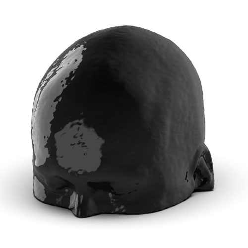 WEK50-04 CTA頭模，帶AVM CTA頭模，WEK50-04 CT血管造影頭模