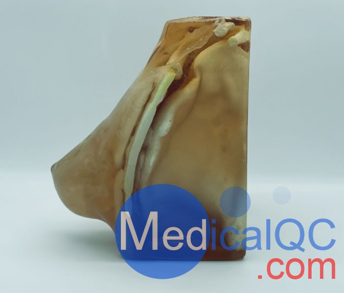 BT-A02乳腺模體,BT-A02成人乳腺模型產品實拍圖