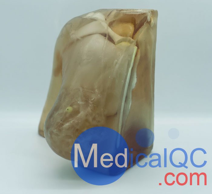 BT-A02乳腺模體,BT-A02成人乳腺模型產品實拍圖