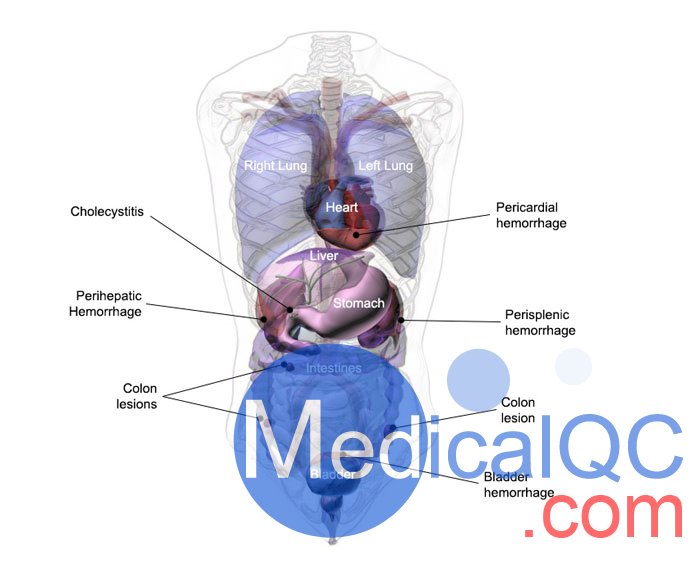 US-A04 FAST訓練軀干模體，US-A04超聲軀干模體