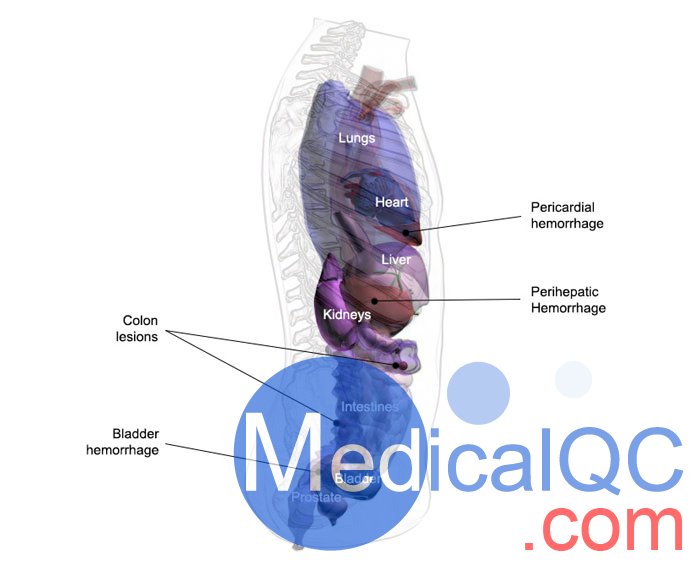 US-A04 FAST訓練軀干模體，US-A04超聲軀干模體