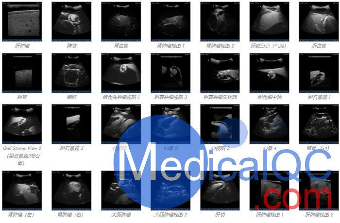 US-A04 FAST訓練軀干模體，US-A04超聲軀干模體