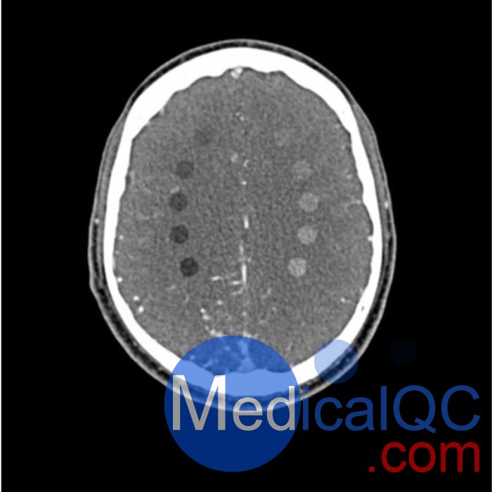 WEK-5005腦血管造影頭模，WEK-5005頭模， CTA AVM頭模成像效果圖