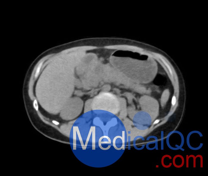 WEK55-02腹部骨盆模體，WEK55-02腹部骨盆模型成像效果圖