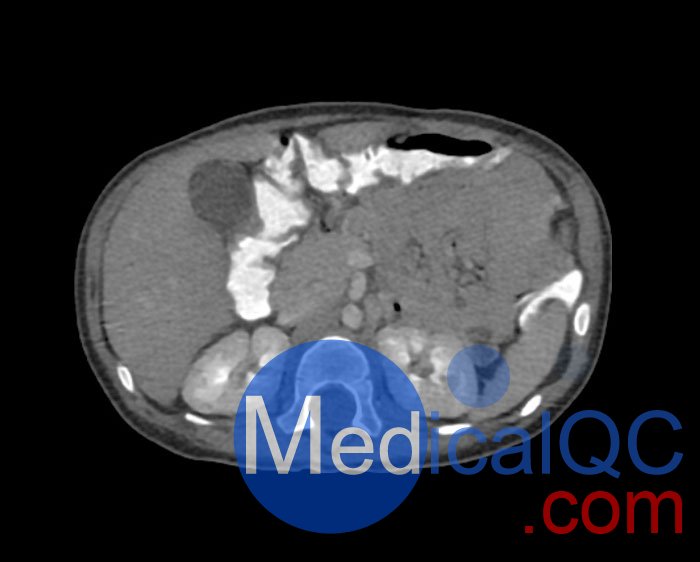WEK58-03兒童軀干模型，WEK58-03兒童軀干模體成像效果圖