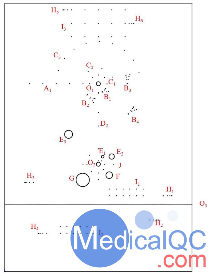 KS107QN-4A型體模探查孔、靶線及模擬病灶分布