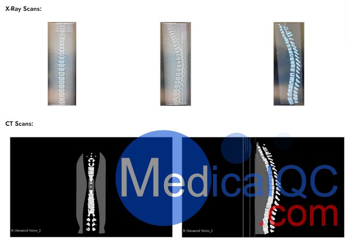 SE-A01成人脊柱模型,SE-A01成人脊柱模體產品成像效果圖